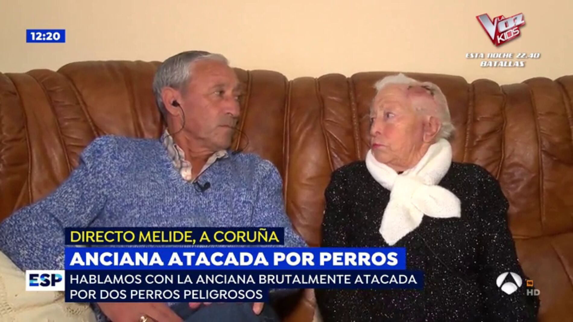 Anciana atacada por perros.