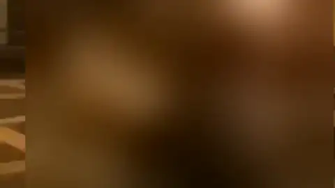 Denuncian una brutal agresión a un joven discapacitado en Gran Canaria Denuncian una brutal agresión a un joven discapacitado en Gran Canaria