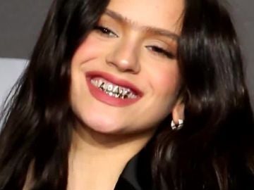 El peligro de los 'grillz' de Rosalía: La tendencia de los dientes de oro 