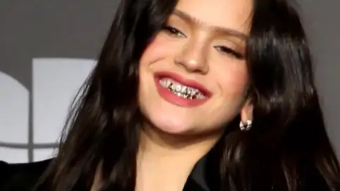 El peligro de los 'grillz' de Rosalía: La tendencia de los dientes de oro El peligro de los 'grillz' de Rosalía: La tendencia de los dientes de oro