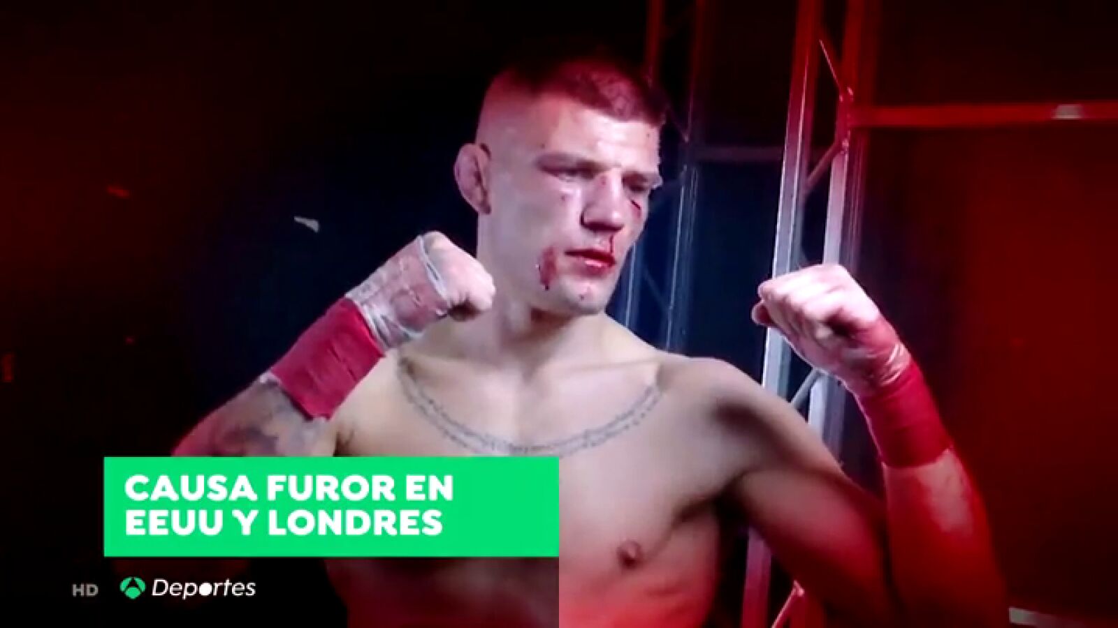 Lo llaman 'boxeo sin guantes' y causa furor en Estados Unidos y Londres
