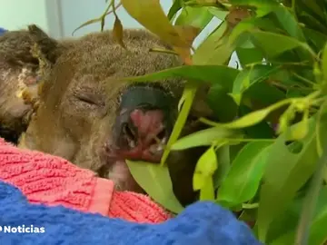 El koala rescatado en medio de las llamas se recupera en un hospital de Australia El koala rescatado en medio de las llamas se recupera en un hospital de Australia