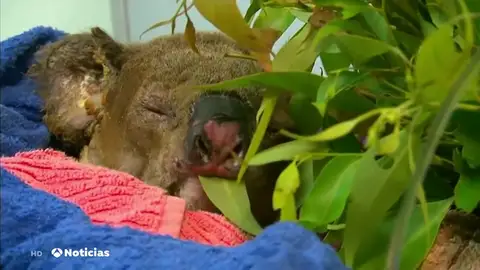 El koala rescatado en medio de las llamas se recupera en un hospital de Australia El koala rescatado en medio de las llamas se recupera en un hospital de Australia