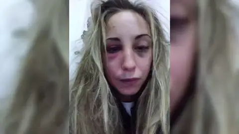 "Así me ha dejado al divertirse": una joven comparte el maltrato sufrido en redes sociales "Así me ha dejado al divertirse": una joven comparte el maltrato sufrido en redes sociales