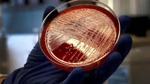 Nuevos fármacos para el cáncer de mama Nuevos fármacos para el cáncer de mama