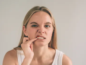 Encías inflamadas Encías inflamadas