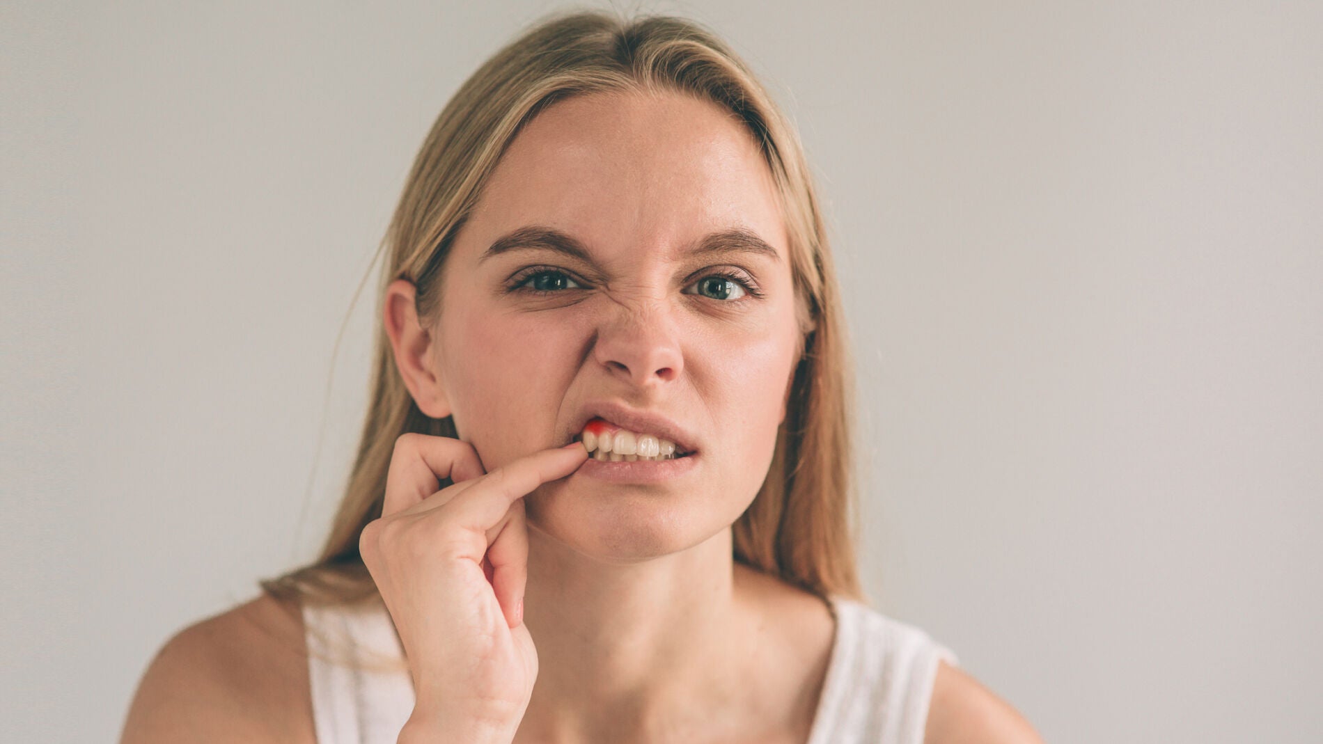 Encías inflamadas