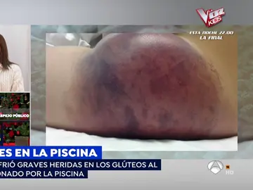 Muertes en la piscina. Muertes en la piscina.