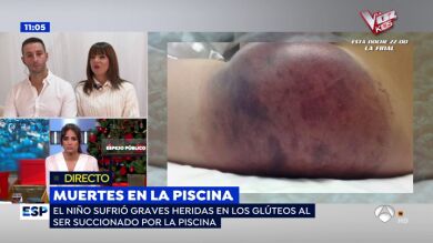 Un niño de 12 años, a punto de morir succionado en una piscina: 