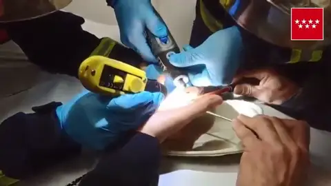 Unos bomberos de Cercedilla sacan un anillo con una Dremel Unos bomberos de Cercedilla sacan un anillo con una Dremel