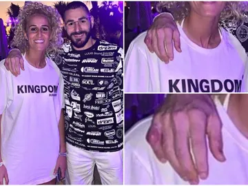 Benzema muestra su dedo fracturado Benzema muestra su dedo fracturado