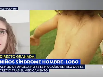 niños hombre lobo niños hombre lobo