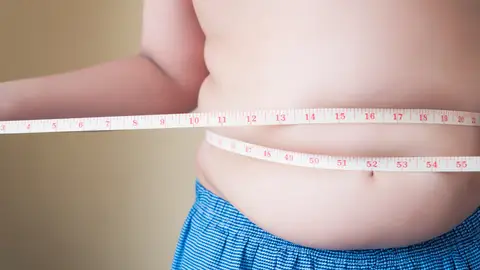 Obesidad infantil Obesidad infantil