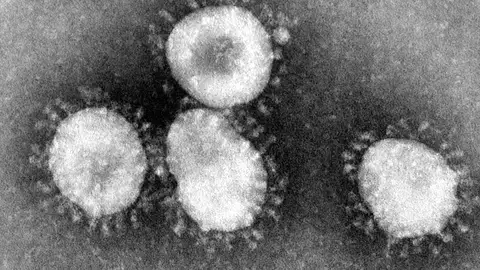 Imagen de un coronavirus Imagen de un coronavirus