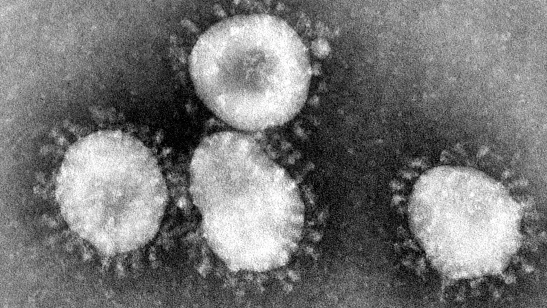 Imagen de un coronavirus Imagen de un coronavirus