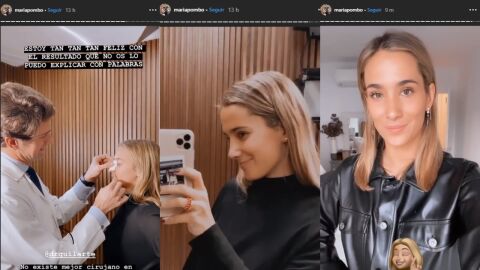 La operación estética de Maria Pombo en su nariz