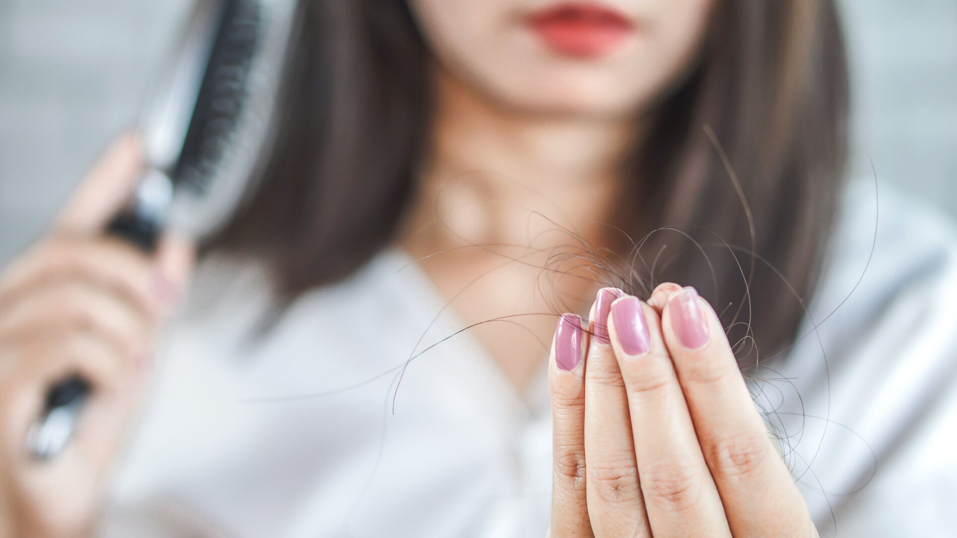 P&eacute;rdida de cabello