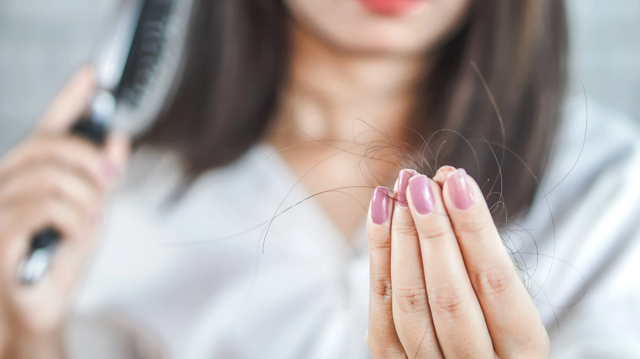 Pérdida de cabello Pérdida de cabello