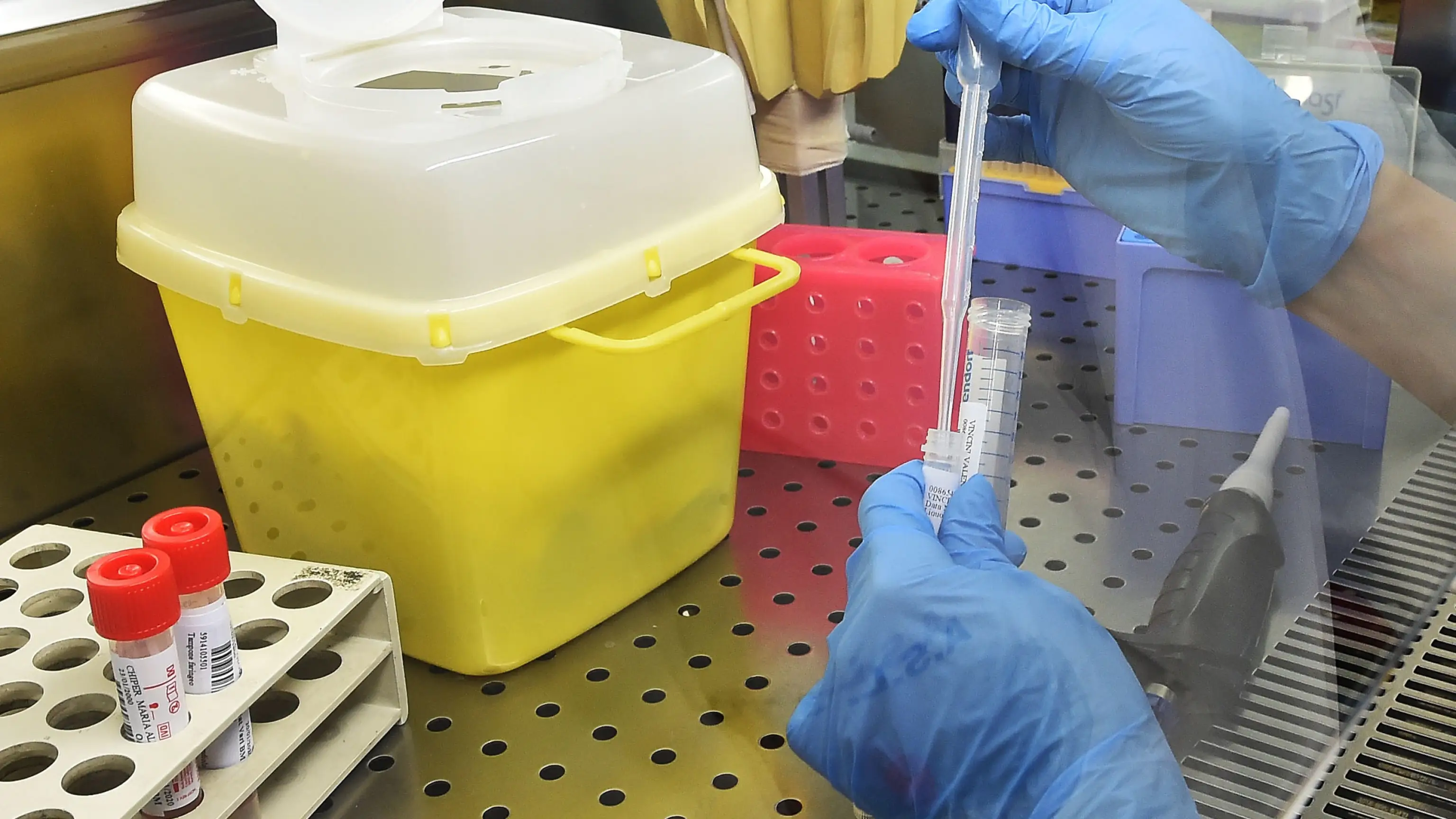 Investigan dos protéinas que podrían ser la cura contra el coronavirus Investigan dos protéinas que podrían ser la cura contra el coronavirus