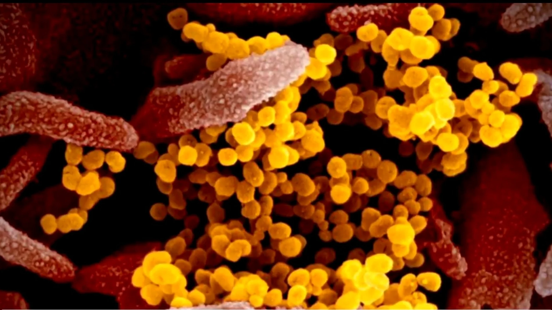 Coronavirus a vista de microscopio Coronavirus a vista de microscopio