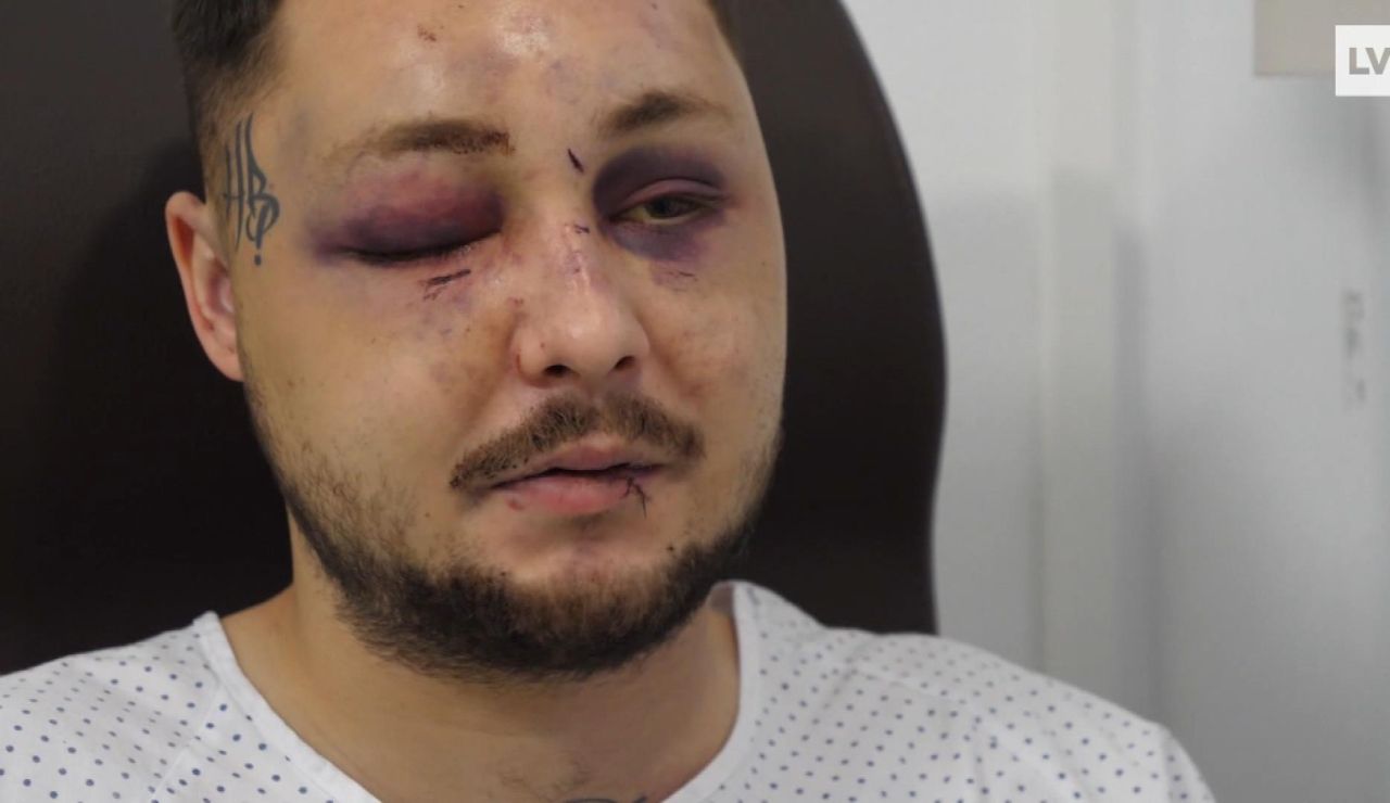 Héroe agredido Héroe agredido