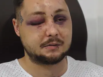 Héroe agredido Héroe agredido