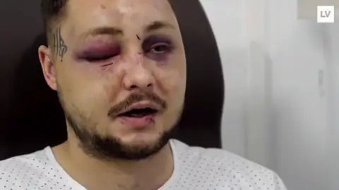 Recibe una brutal paliza por defender a una chica que estaba siendo atacada por su novio Recibe una brutal paliza por defender a una chica que estaba siendo atacada por su novio