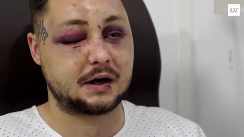 Recibe una brutal paliza por defender a una chica que estaba siendo atacada por su novio