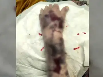 Brutal agresión Brutal agresión