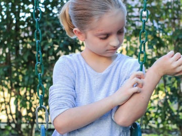 Niño con dermatitis