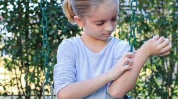 Niño con dermatitis Niño con dermatitis