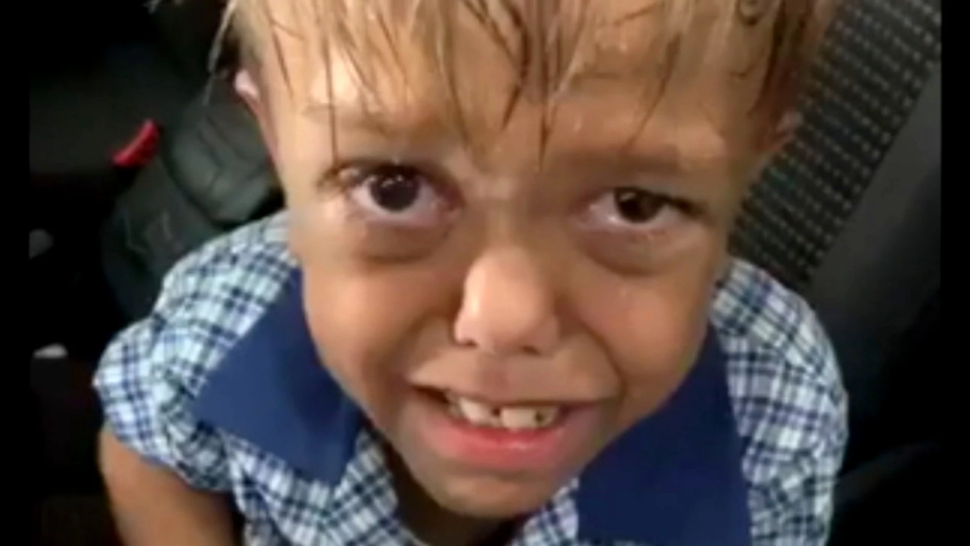 Quaden tiene 9 años y sufre Bullying constantemente en el colegio Quaden tiene 9 años y sufre Bullying constantemente en el colegio