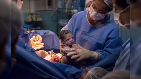 Isabela, la bebé que nació enfadada se vuelve viral Isabela, la bebé que nació enfadada se vuelve viral