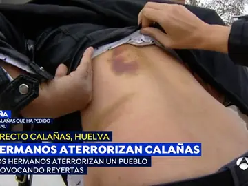 Hermanos aterrorizan Calañas. Hermanos aterrorizan Calañas.