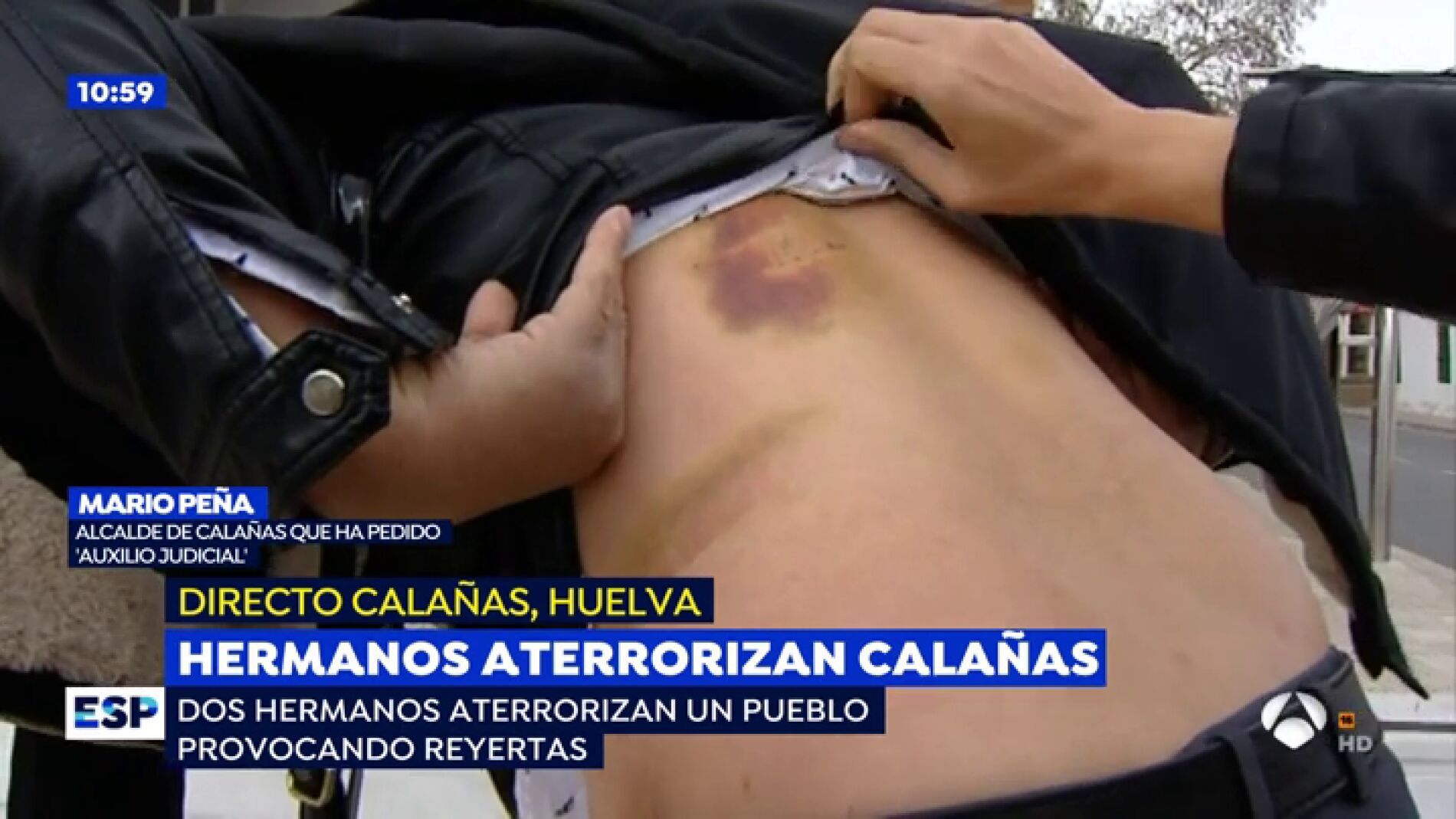 Hermanos aterrorizan Cala&ntilde;as.