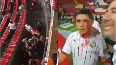 varios heridos en una terrible pelea multitudinaria entre ultras radicales varios heridos en una terrible pelea multitudinaria entre ultras radicales