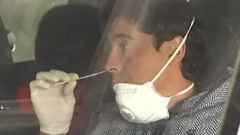 Test PCR del coronavirus Test PCR del coronavirus