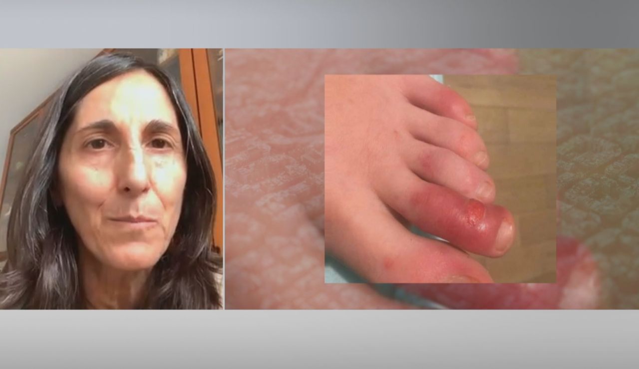 Coronavirus en los niños Coronavirus en los niños
