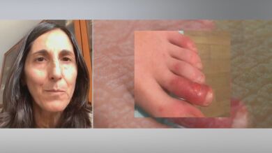 Detectan que el coronavirus produce inflamación de extremidades en niños asintomáticos