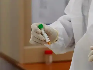 Pruebas en laboratorio de la vacuna contra el coronavirus Pruebas en laboratorio de la vacuna contra el coronavirus