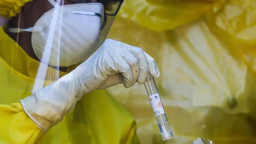 Última hora del coronavirus hoy en España y el mundo: muertos, infectados y datos actualizados Viales para hacer el test de coronavirus