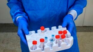 Un cient&iacute;fico sostiene varias muestras