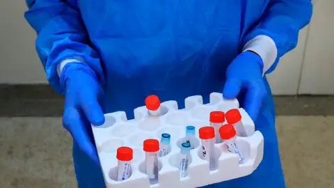 Un científico sostiene varias muestras Un científico sostiene varias muestras