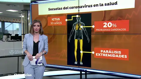 Secuelas del coronavirus Secuelas del coronavirus