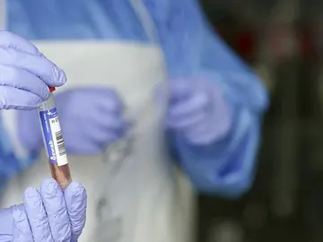 Un sanitario protegido con guantes sostiene un muestra para realizar un Análisis PCR Un sanitario protegido con guantes sostiene un muestra para realizar un Análisis PCR