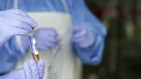 Un sanitario protegido con guantes sostiene un muestra para realizar un Análisis PCR Un sanitario protegido con guantes sostiene un muestra para realizar un Análisis PCR