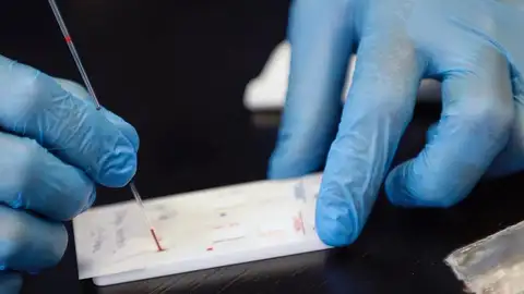 Los anticuerpos de un paciente recuperado del SARS podrían neutralizar de manera natural al coronavirus Ciencia