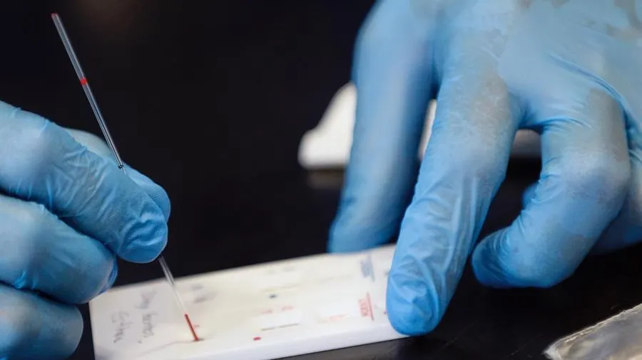 Los anticuerpos de un paciente recuperado del SARS podrían neutralizar de manera natural al coronavirus Ciencia