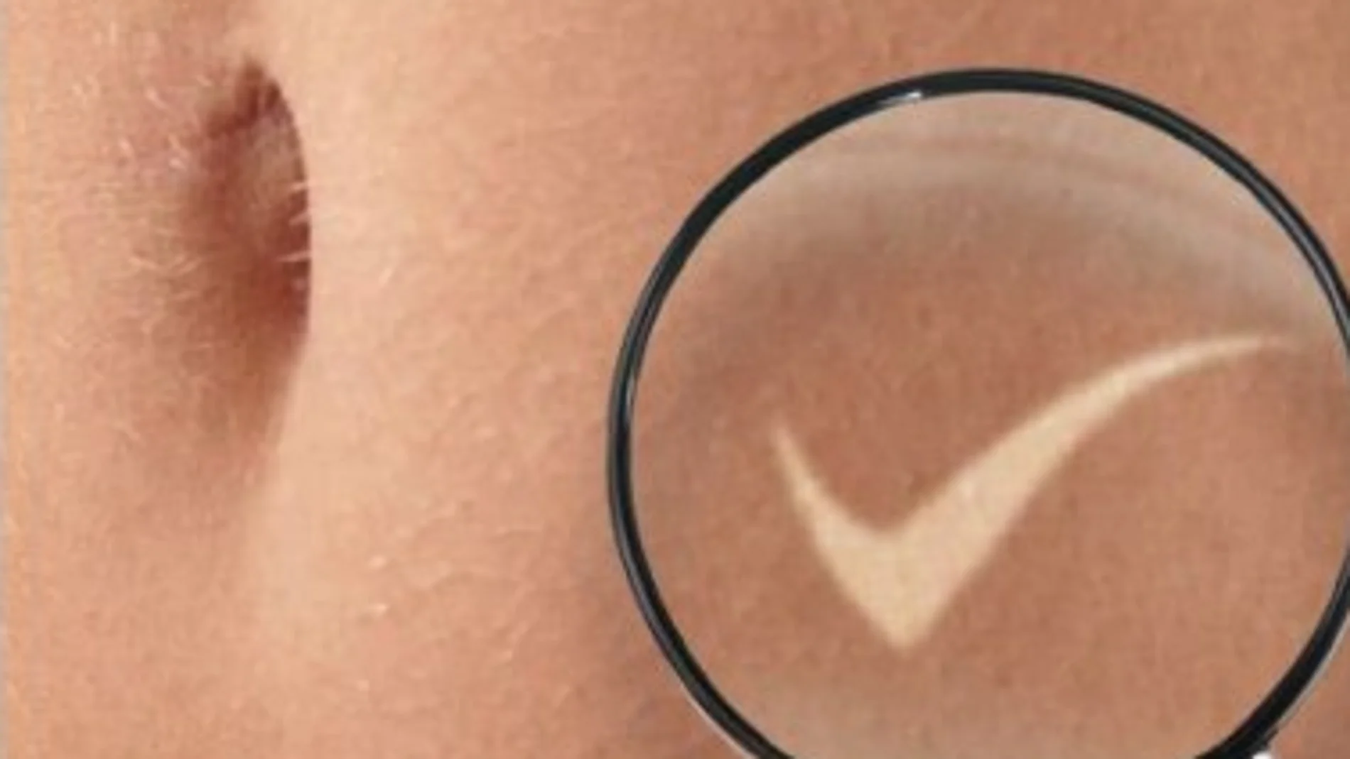 Cáncer de colon. Causas, síntomas, diagnóstico y tratamientos Cáncer de colon. Causas, síntomas, diagnóstico y tratamientos