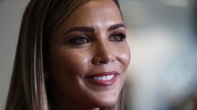 Rosanna Zanetti muestra sin filtros las estrías que tiene tras sus dos embarazos: ''No existe una crema milagrosa'' 